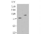 Factor XIII A Antibody in Western Blot (WB)