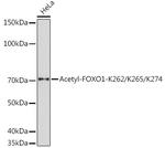Acetyl-FOXO1 (Lys262, Lys265, Lys274) Antibody in Western Blot (WB)