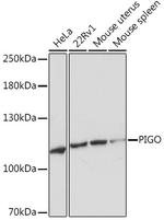 PIGO Antibody in Western Blot (WB)