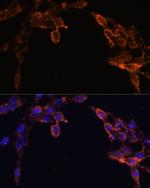 Cytochrome P450 Reductase Antibody in Immunocytochemistry (ICC/IF)