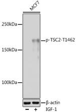 Phospho-TSC2 (Thr1462) Antibody in Western Blot (WB)
