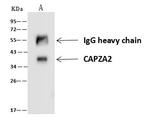 CAPZA2 Antibody in Immunoprecipitation (IP)