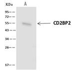 CD2BP2 Antibody in Immunoprecipitation (IP)