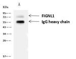 FIGNL1 Antibody in Immunoprecipitation (IP)