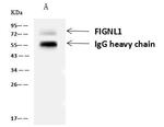 FIGNL1 Antibody in Immunoprecipitation (IP)