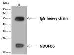 NDUFB6 Antibody in Immunoprecipitation (IP)