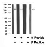 Phospho-E-cadherin (Ser844) Antibody in Western Blot (WB)