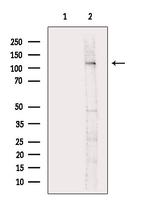 Phospho-EphB3 (Tyr608) Antibody in Western Blot (WB)