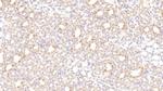 LEPR Antibody in Immunohistochemistry (Paraffin) (IHC (P))