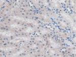 MYO1D Antibody in Immunohistochemistry (Paraffin) (IHC (P))
