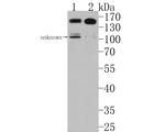 PLCB1 Antibody in Western Blot (WB)