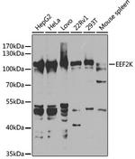 EEF2K Antibody in Western Blot (WB)