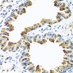SERPINA10 Antibody in Immunohistochemistry (Paraffin) (IHC (P))