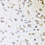 SERPINA10 Antibody in Immunohistochemistry (Paraffin) (IHC (P))