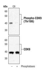 Phospho-CDK9 (Thr186) Antibody in Western Blot (WB)