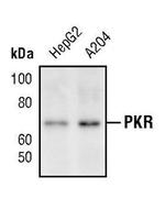 PKR Antibody in Western Blot (WB)
