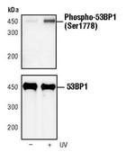 Phospho-53BP1 (Ser1778) Antibody in Western Blot (WB)