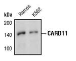 CARD11 Antibody in Western Blot (WB)