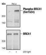 Phospho-BRCA1 (Ser1524) Antibody in Western Blot (WB)