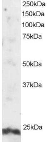 ARL4A Antibody in Western Blot (WB)