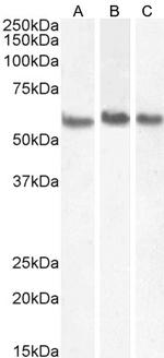Coronin 1A Antibody in Western Blot (WB)