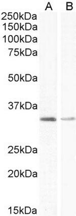 UCP1 Antibody in Western Blot (WB)