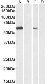 Arylsulfatase A Antibody in Western Blot (WB)