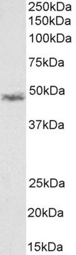 CCM2 Antibody in Western Blot (WB)