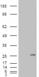 IGFBP6 Antibody in Western Blot (WB)