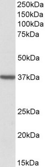 TOMM40 Antibody in Western Blot (WB)