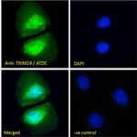 TRIM29 Antibody in Immunocytochemistry (ICC/IF)