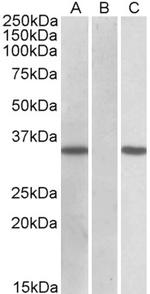 CRISP2 Antibody in Western Blot (WB)