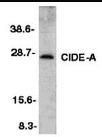 CIDEA Antibody in Western Blot (WB)