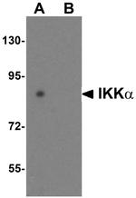 IKK alpha Antibody in Western Blot (WB)