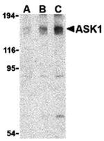 ASK1 Antibody in Western Blot (WB)