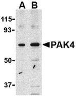 PAK4 Antibody in Western Blot (WB)
