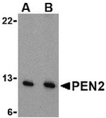 PEN2 Antibody in Western Blot (WB)