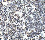 MDA5 Antibody in Immunohistochemistry (IHC)