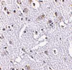 TIGAR Antibody in Immunohistochemistry (IHC)