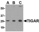 TIGAR Antibody in Western Blot (WB)