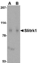 SLITRK1 Antibody in Western Blot (WB)