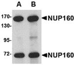 NUP160 Antibody in Western Blot (WB)