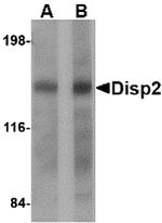 DISP2 Antibody in Western Blot (WB)