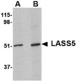 Lass5 Antibody in Western Blot (WB)