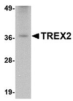 TREX2 Antibody in Western Blot (WB)