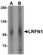 LRFN1 Antibody in Western Blot (WB)