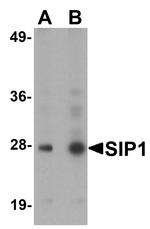 Gemin 2 Antibody in Western Blot (WB)