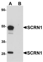 SCRN1 Antibody in Western Blot (WB)