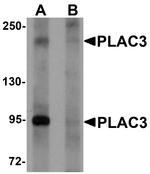 PAPPA2 Antibody in Western Blot (WB)