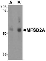 MFSD2A Antibody in Western Blot (WB)